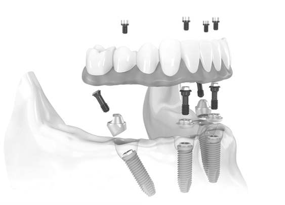 Studio dentistico dr. Pedja Misljenovic 